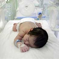 Report calls attention to millions of preterm births