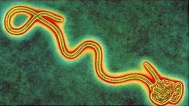 英国寄宿学校发布埃博拉应急指南