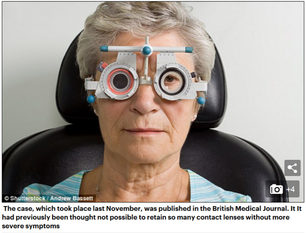 老妇眼睛不适就医，竟取出27枚隐形眼镜