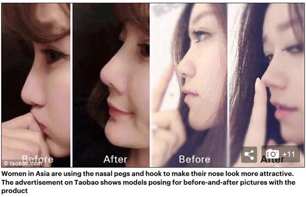 中日韩女性流行“美鼻神器” 专家警告：有生命危险