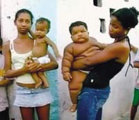 奇闻：哥伦比亚11个月男婴体重赶超八岁儿童