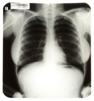 梦露胸部X光片拍得4.5万美元高价