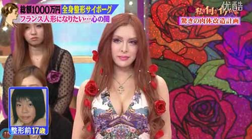 日本女模花10万美元整容30多次 欲成法式美女