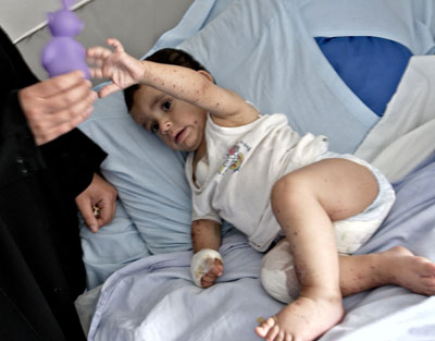 Children suffer from Israel's bombing