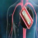 New device, new studies hold out hope for heart patients