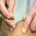 Acupuncture triggers natural painkillers