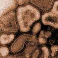 关注甲型H1N1流感