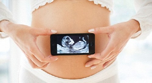英国准妈妈流行发“胎儿自拍”让网友猜测性别
